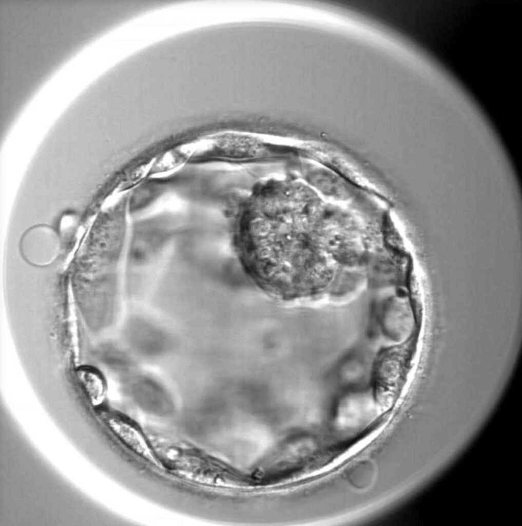 Real-time embryo monitoring with MyEmbryoViewer at Twig Fertility Toronto and Vancouver.